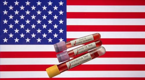 ABD'de Kovid-19 nedeniyle son 24 saatte 4 bin 931 ölüm