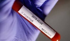 Koronavirüs salgınında son 24 saat