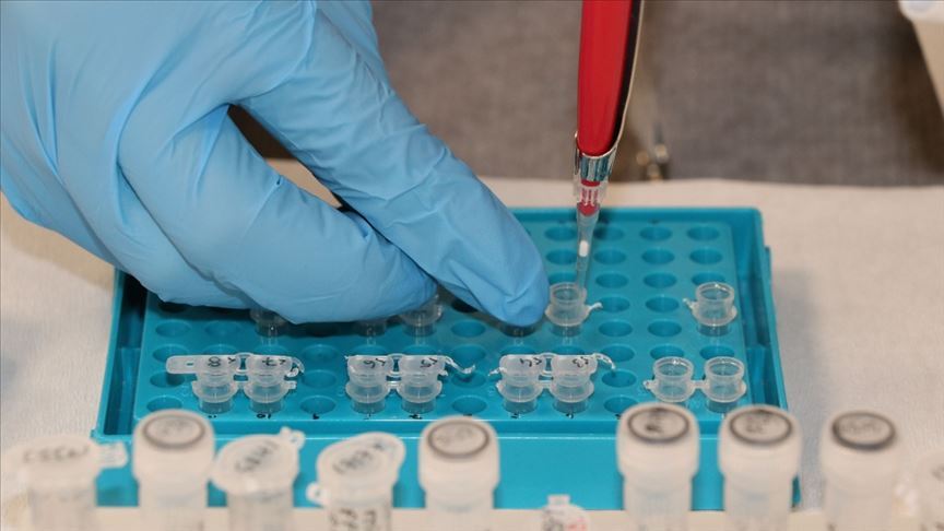 Yüksek kortizol Kovid-19 hastalarında ölüm riskini artırabilir