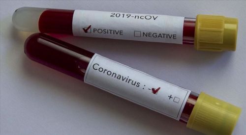 Avrupa Birliği Kovid-19 tedavisi için 'Remdesivir' alacak