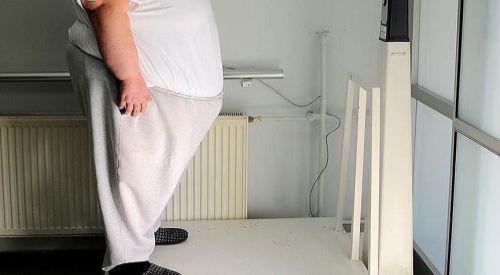 Kovid-19'lu obez kişilerin ölüm riski yüksek