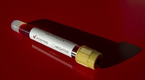 Kovid-19'dan korunmak için 'kutsal iksir' içen Sri Lankalı Sağlık Bakanı virüse yakalandı