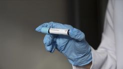 Kovid-19 ardında 'Post Kovid' izler bırakıyor