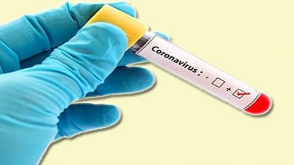 Dünden beri kayıtlara geçen yeni vakalar açıklandı 