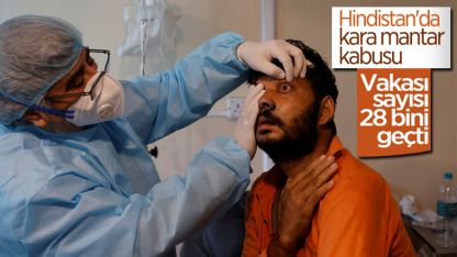 Hindistan’da kara mantar vakası sayısı 28 bini geçti