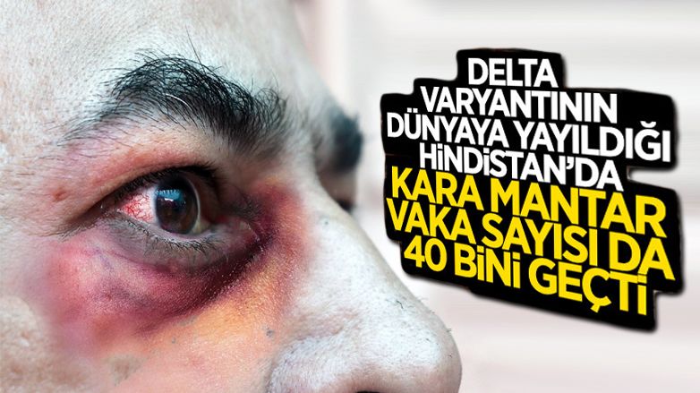 Hindistan'da kara mantar vaka sayısı 40 bini geçti