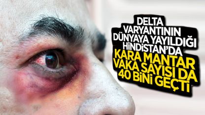 Hindistan'da kara mantar vaka sayısı 40 bini geçti