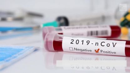 Koronavirüs salgınında son 24 saat