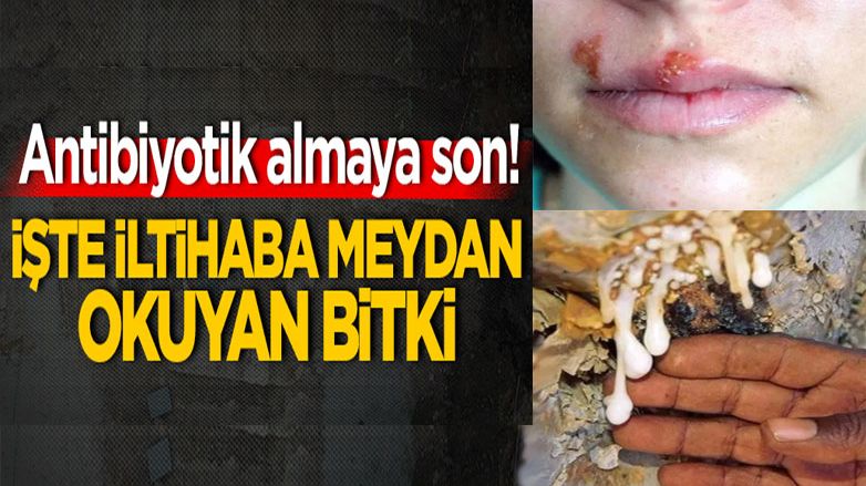 İltihaba meydan okuyan bitki: Akgünlük