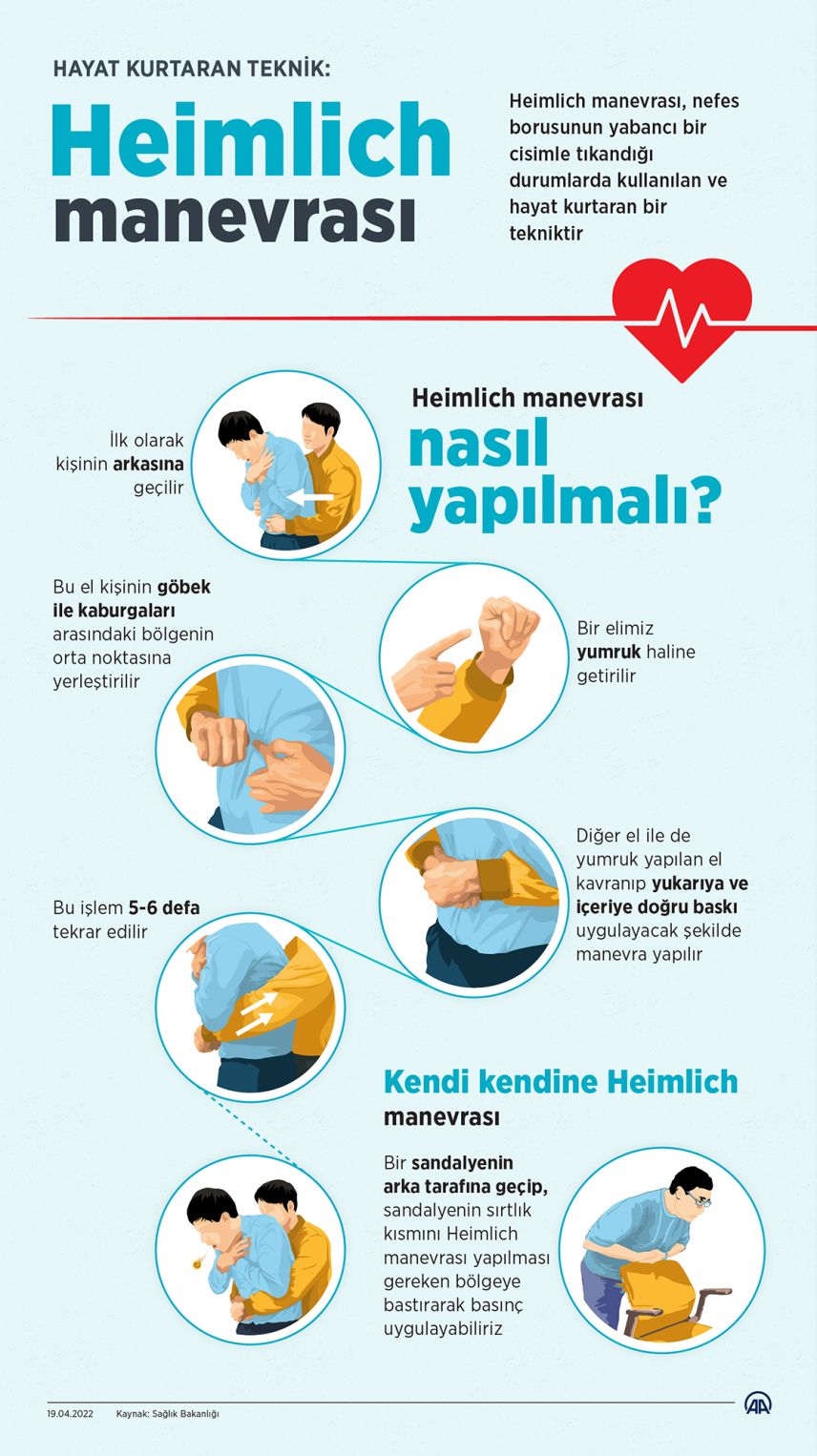 Hayat kurtaran teknik: Heimlich manevrası