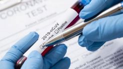 Yunanistan'da yeni vakalar açıklandı