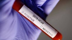 Yunanistan'da vakalarda son 24 saat