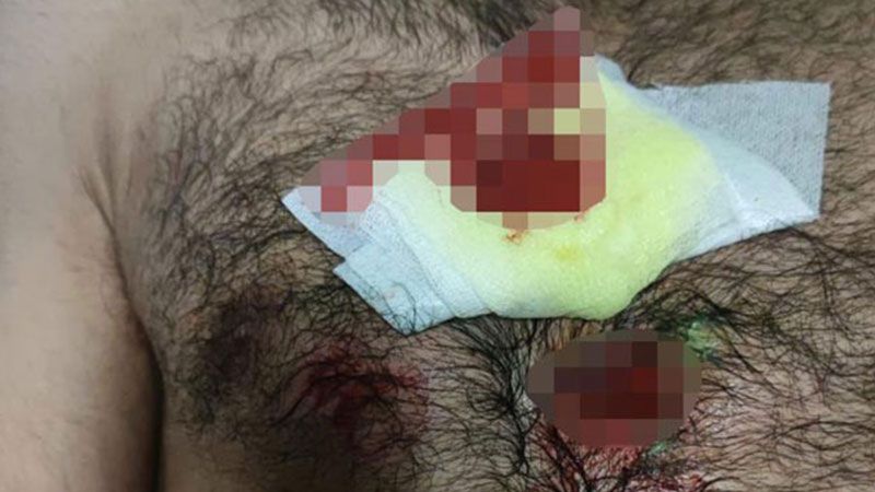 Yunanistan güvenlik güçleri göçmeni plastik mermiyle yaraladı