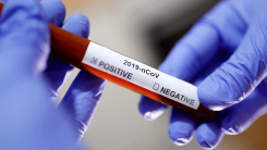 Yunanistan'ın yeni vakaları açıklandı