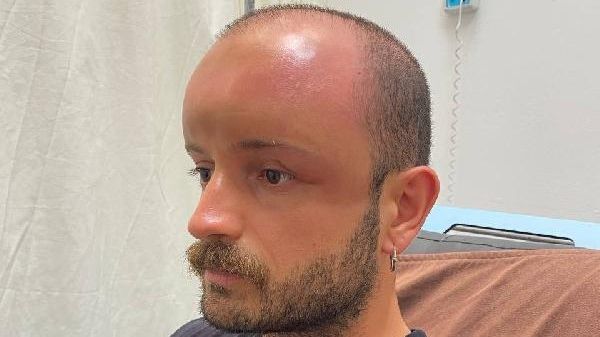 Denize giden adam, milyonda bir görülen rahatsızlığa yakalandı