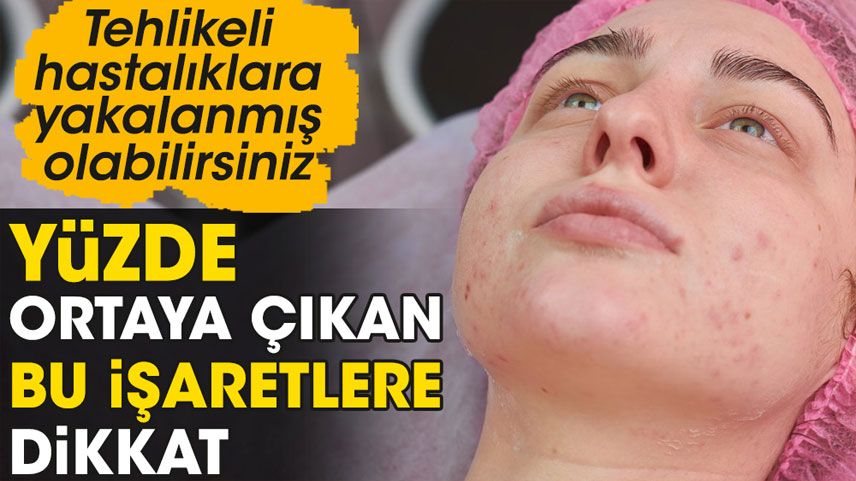 Yüzde ortaya çıkan 10 tehlikeli hastalık