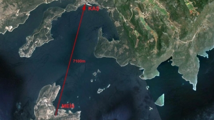 Parmağı kopan Stamatis Türkiye'de ameliyat edildi