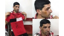 ΚΕΕΡΦΑ: Καταγγελία για «ρατσιστικές επιθέσεις φασιστοειδών» κατά μεταναστών 