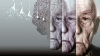Dünyada her 3,2 saniyede bir kişi, Alzheimer hastalığına yakalanıyor