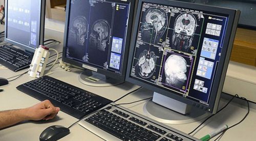 Türk Bilim Adamları Beynin Sırlarını Çözüyor