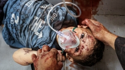 İsrail'in saldırıları altındaki Gazze'de yaşamak; açlık, soğuk ve çocuk olamamak demek