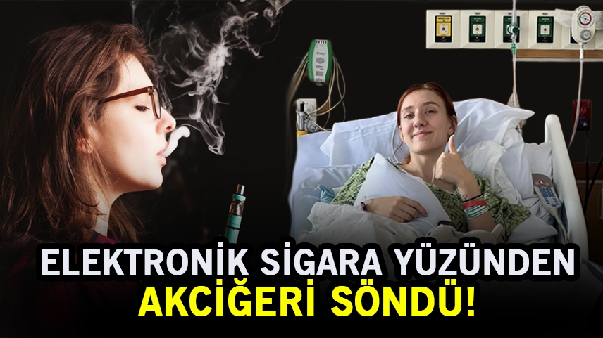 20 yaşındaki kız elektronik sigara nedeniyle canından oluyordu