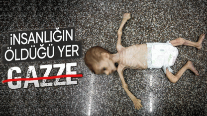 Gazze'de bir bebek daha açlık yüzünden can verdi...