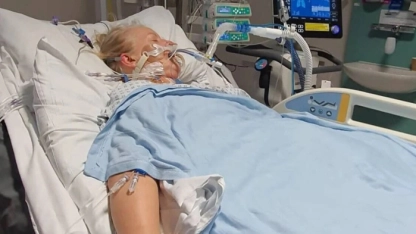 Et yiyen bakteriler burnunu yedi, ölümden döndü