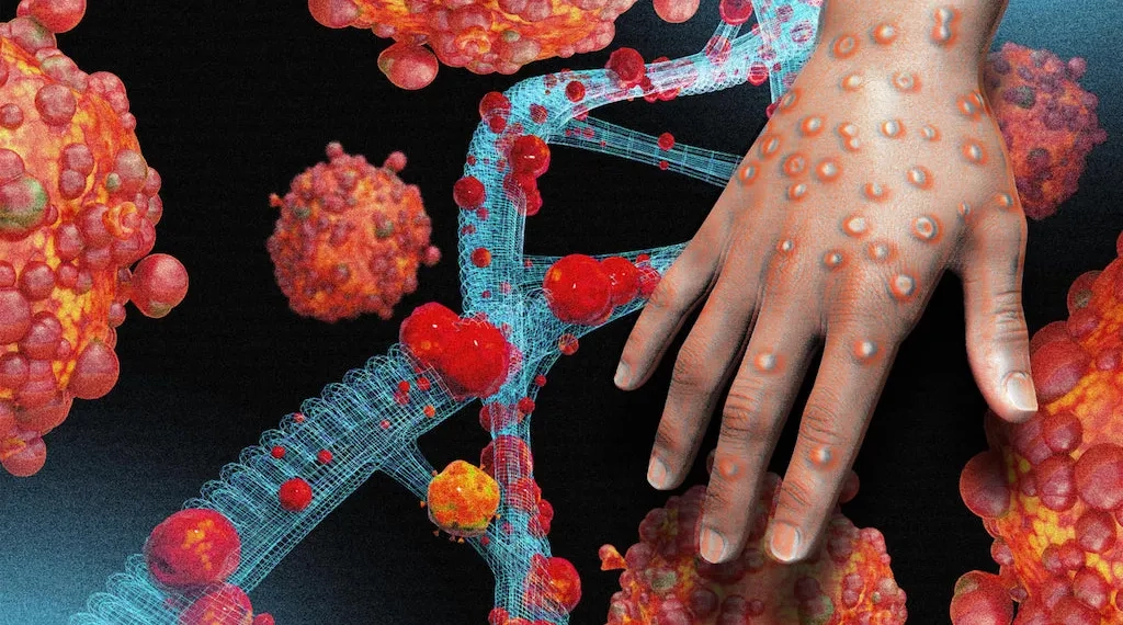 Dünya Sağlık Örgütü: Yeni Maymun çiçeği salgını kontrol altına alınabilir ve durdurulabilir