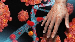 Maymun çiçeği vakalarında artış: Kasım ve aralık aylarında 18 yeni vaka