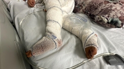 Sınır Tanımayan Doktorlar: İsrail'in Gazze'de saldırılara yeniden başlamasıyla yanık vakaları arttı