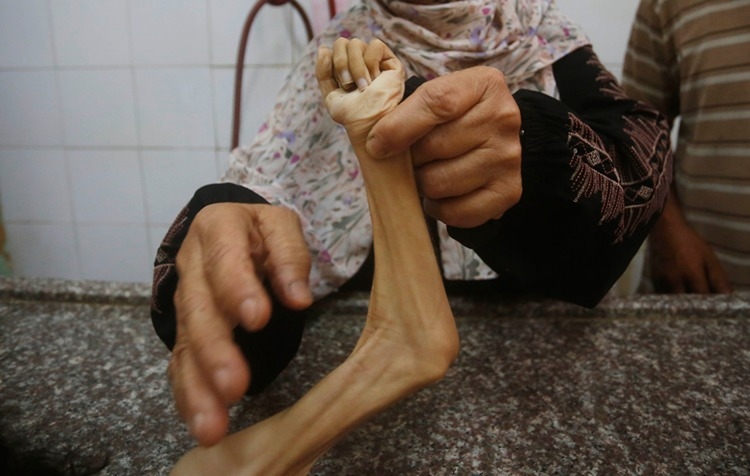  İsrail'in Gazze'ye saldırılarında hayatını kaybedenlerin sayısı 59 bini aştı