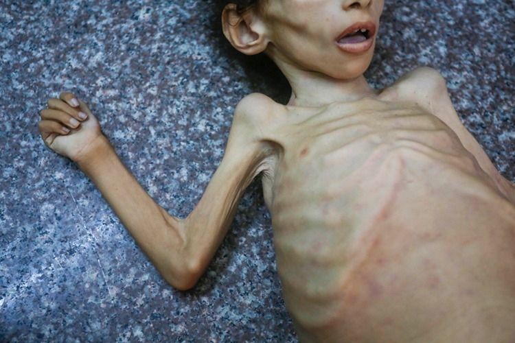  İsrail'in Gazze'ye saldırılarında hayatını kaybedenlerin sayısı 59 bini aştı