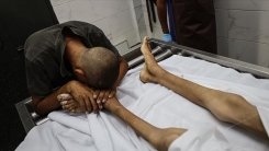 Gazze Şeridi'nde bir çocuk daha İsrail’in dayattığı açlık nedeniyle hayatını kaybetti