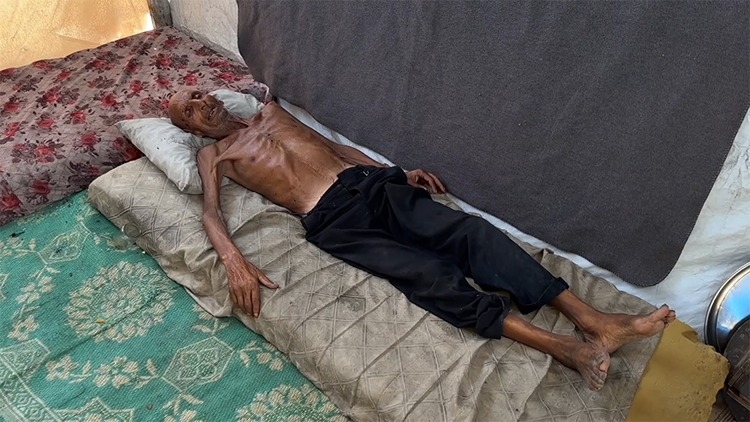 Gazze Şeridi'nde 75 yaşındaki yaşlı adam, İsrail'in dayattığı açlık nedeniyle 40 kiloya düştü