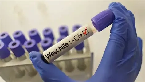 Batı Nil virüsü Yunanistan'da iki can daha aldı