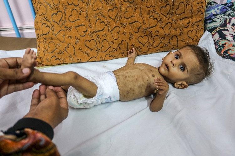 İsrail'in kıtlığı dayattığı Gazze'de son 24 saatte 2'si çocuk 6 kişi daha açlıktan hayatını kaybetti