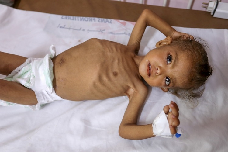 İsrail'in kıtlığı dayattığı Gazze'de son 24 saatte 2'si çocuk 6 kişi daha açlıktan hayatını kaybetti