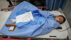 DSÖ, Gazze'de 16 bin 500'den fazla kişinin acil tıbbi bakıma ihtiyaç duyduğunu bildirdi