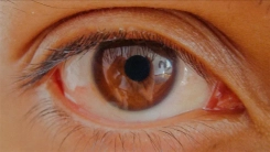 Göz tansiyonunda erken teşhis kalıcı körlüğün önüne geçiyor