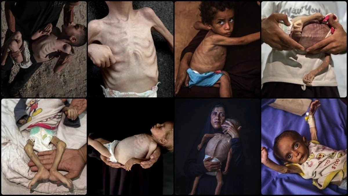 BM: Gazze'de akut yetersiz beslenme vakası 95 bine çıktı