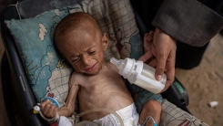 DSÖ: Gazze'de 18 bin 500'den fazla hastanın tahliye edilmesi gerekiyor