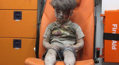 Halep'te Ümran gibi 100 binden fazla çocuk var