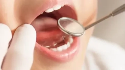 Dentist Pass geri dönüyor: Hangi çocuklar yararlanacak?