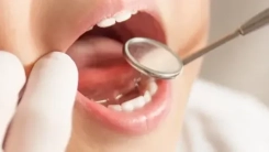 Dentist Pass geri dönüyor: Hangi çocuklar yararlanacak?