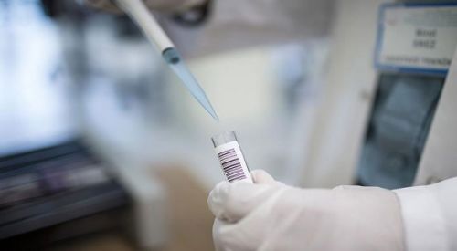 Alzaymırı tedavi eden molekül bulundu