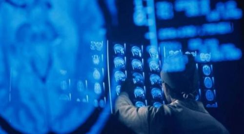 Bilim adamları ölümle ilgili bir gizemi açıkladı