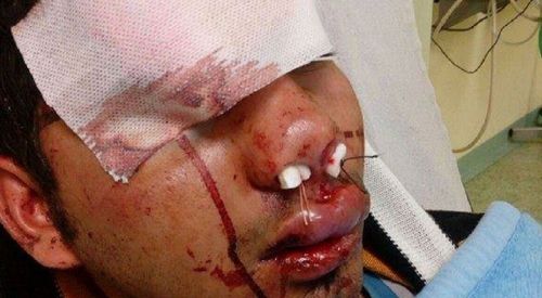 Ρατσιστική επίθεση σε μετανάστη στον Ασπρόπυργο