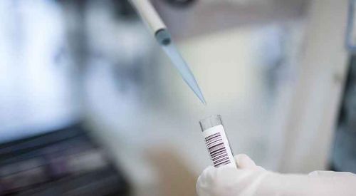 Alzaymırı önleyebilecek yeni bir reseptör hücre keşfedildi