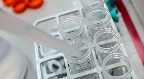 Oruç tutmak kök hücrelerin yenilenme fonksiyonunu artırıyor